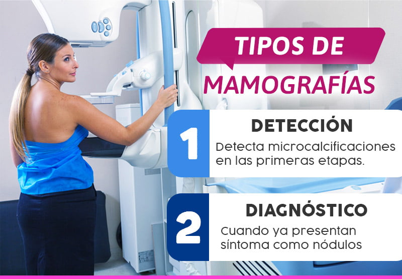 tipos-de-mamografias-cancer-mama